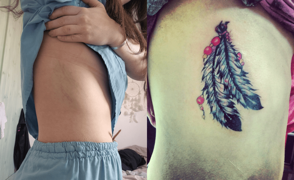 תמונות-לפני-אחרי-לגלריה-1