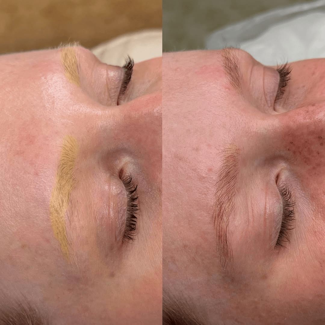 הסרת איפור קבוע ברימובר (מלחים) – מחיר ומידע